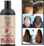 Nonigoodness Onion Black Seed Hair Oil – With Comb Applicator – Controls Hair Fall – No Mineral Oil, Silicones, Cooking Oil & Synthetic Fragrance Hair Oil (100 Ml) Hair Oil(100 Ml)
